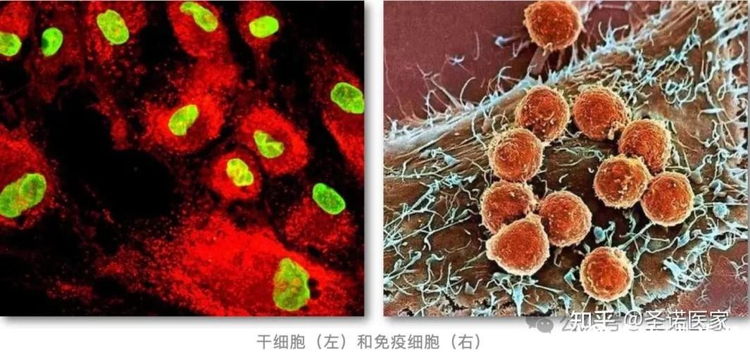 免疫系统为何阻止不了肿瘤转移？这项成果破解谜题，登上《细胞》